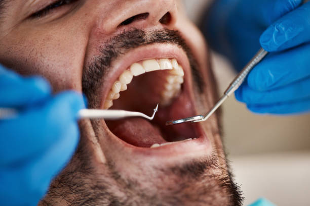 Best Emergency Care for Gum Disease in Apalachin, NY